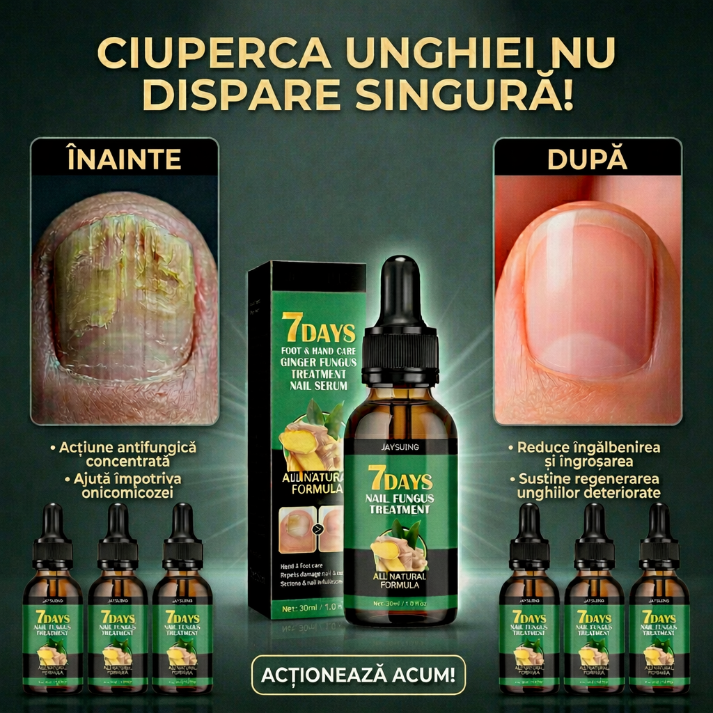 Tratament lichid natural pentru ciuperca unghiilor cu extract de ghimbir si plante naturale