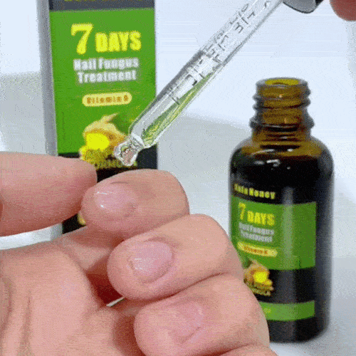 Tratament lichid natural pentru ciuperca unghiilor cu extract de ghimbir si plante naturale